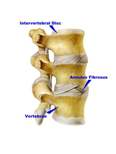 disc injury annuls fibrous chiropractic jacksonville