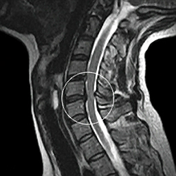 jacksonville-arlington-chiropractor-mri-auto-accident-mva